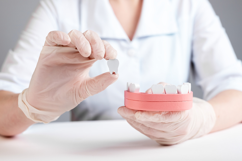 Dental bridge at Trusted Dental Los Angeles CA