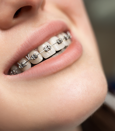 Gum disease treatment at Trusted Dental Los Angeles CA
