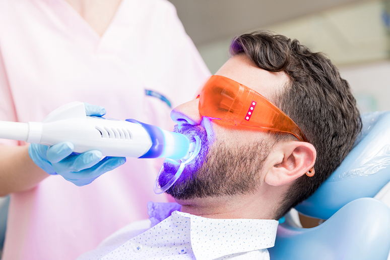 Teeth whitening before and after at Trusted Dental Los Angeles CA