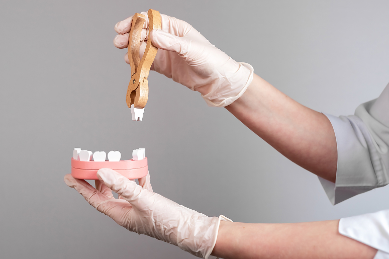 Tooth extraction procedure at Trusted Dental Los Angeles CA